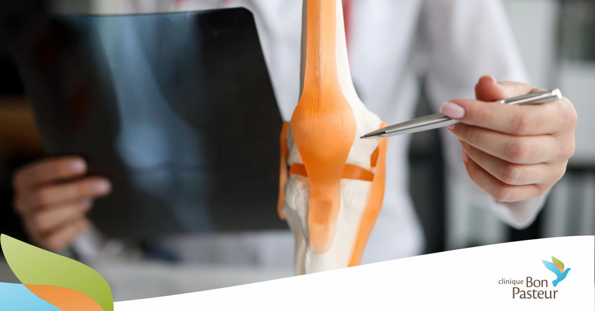 Arthrose : une maladie chronique douloureuse
